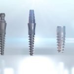 German teeth implants